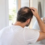 תמונה של גבר מקריח מסתכל על עצמו במראה