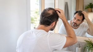 תמונה של גבר מקריח מסתכל על עצמו במראה